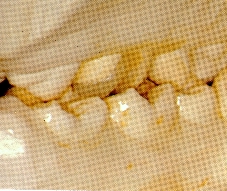 COMPROBAR OCLUSION